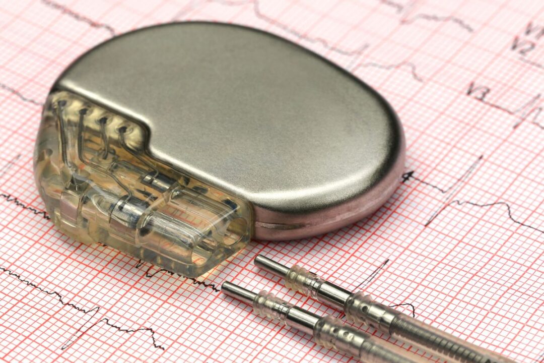 Invenzioni femminili pacemaker