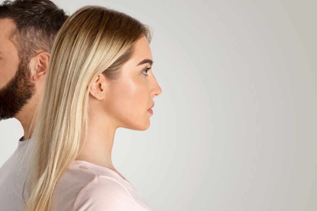 Narcisismo femminile